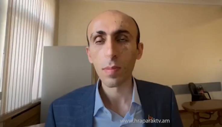 Արցախի եւ Հայաստանի իշխանությունների միջեւ երկխոսությունը բավարար մակարդակի վրա չէ․ Արտակ Բեգլարյան