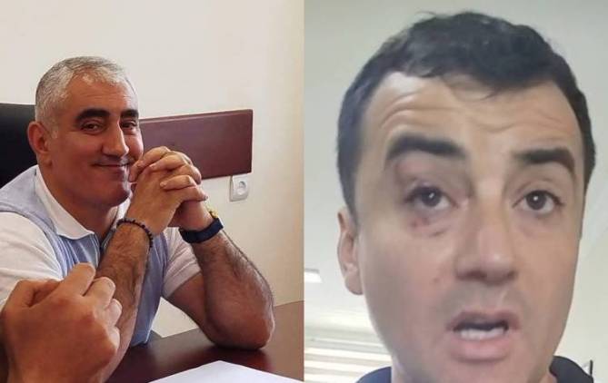 Ողբերգությունը մարդու կորուստն է