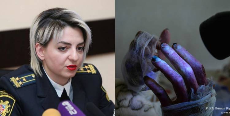 Ֆոսֆորային զենքից տուժածների համար նախատեսված հետայրվածքային բինտերի համար մաքսազերծում են պահանջում