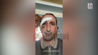 «Հրապարակ»․ Ծեծողը ծեծվողից ներողություն է խնդրել
