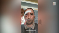 Избивший попросил прощения у избитого