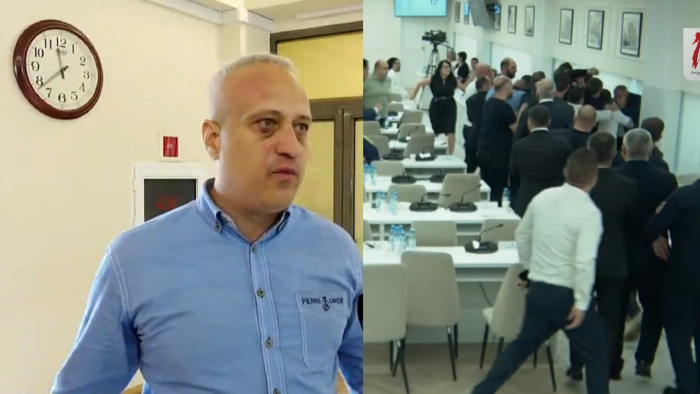 Սարգիս Տեր-Եսայանը լուրջ վնասվածքներ է ստացել. նա մանրամասներ է հայտնում ծեծկռտուքից
