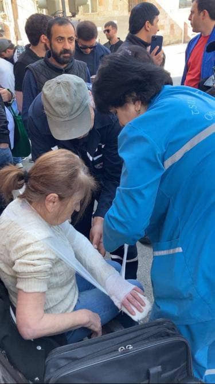 Ոստիկանները կոտրել են 77-ամյա կնոջ ձեռքը