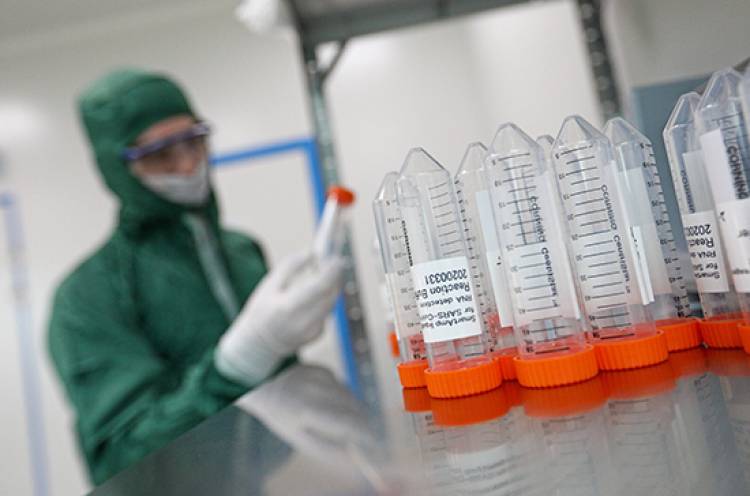 Ռուսաստանում իրականացվել է մոտ 1 միլիոն կորոնավիրուսի առկայության թեստավորում