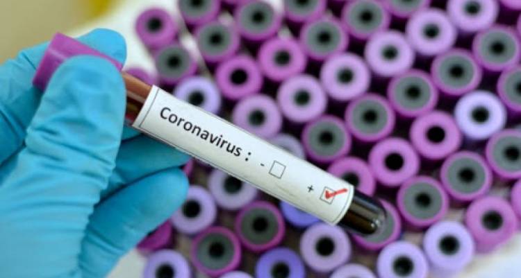 ԱՀԿ-ն կանխատեսել է կորոնավիրուսի վարակի կտրուկ աճ