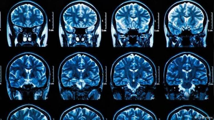 Ինչ հետեւանքներ կարող է թողնել կորոնավիրուսը մարդու գլխուղեղի վրա