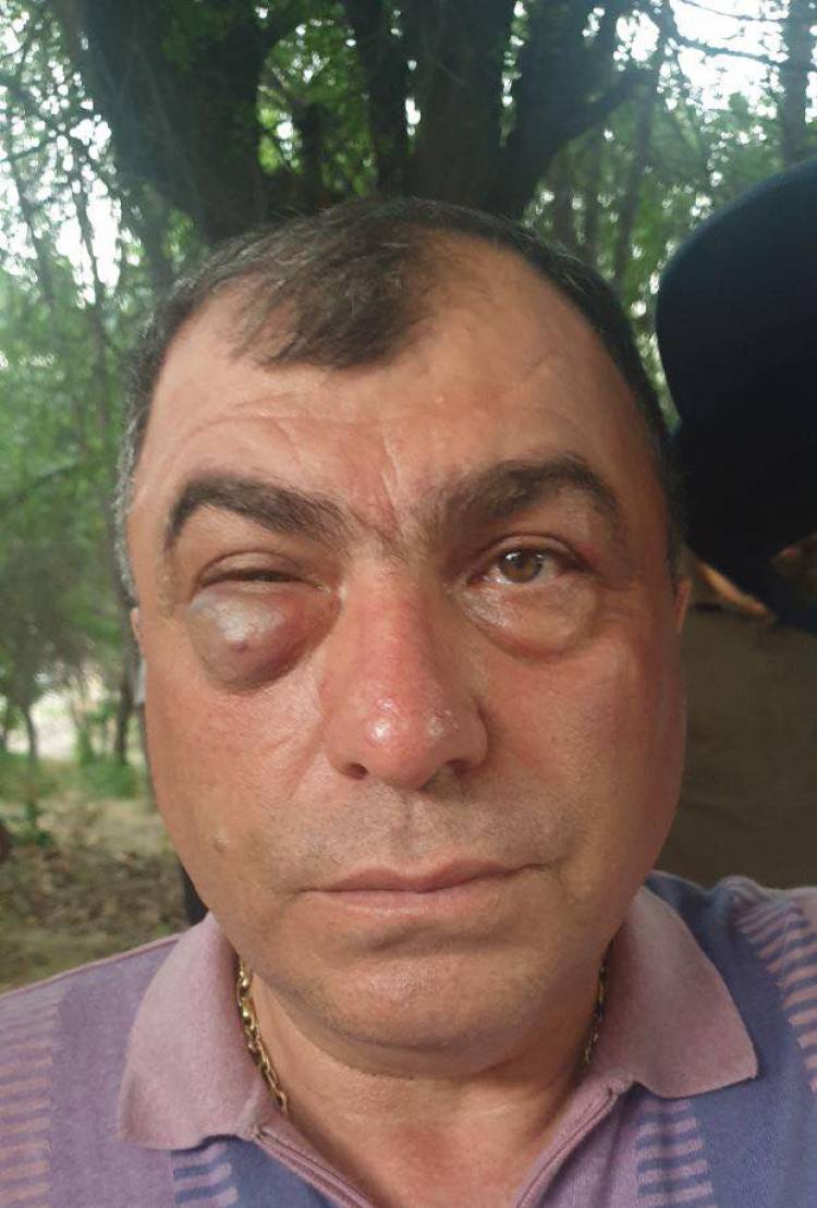 «Հայաստան» դաշինքի ներկայացուցչին ծեծել է Բանգլադեշցի Կարենը՝ Եղեգնաձորի ոստիկանների հետ միասին