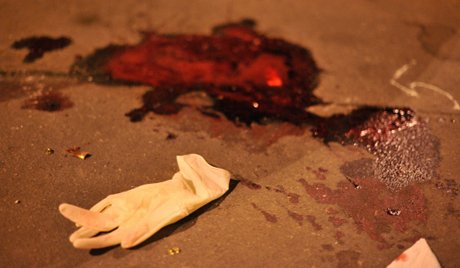 Սպանություն Երևանում. ավտոմեքենայում հայտնաբերվել է հրազենային վնասվածքով 38-ամյա տղամարդու դի